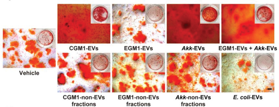 Extracellular Vesicles from Child Gut Microbiota Enter into Bone to Preserve Bone Mass and Strength