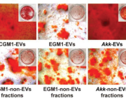 Bone Mass & Strength: The Role of Microbiota Derived Extracellular Vesicles