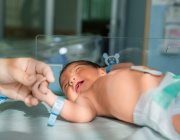 Probiotic Use Increased in US Neonatal Intensive Care Units: Associated With a Decline in Necrotizing Enterocolitis but Not With Sepsis or Mortality Rates