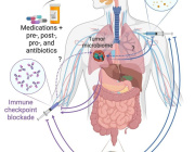 The microbiome and human cancer